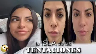 ANA MUESTRA su NUEVO PACK de RETOQUES ESTÉTICOS 