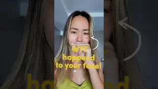 I destroyed my own face :(