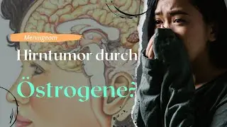 Hirntumor durch Östrogene?
