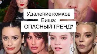Новый ТРЕНД: скулы или молодость? Удаление комков Биша.