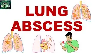 Lung abscess |etiopathogenesis |Morphology |clinical features| complications