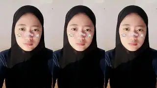 Derra BIGO LIVE | Video # 02 | 