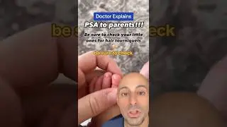 PSA - Must Know for Parents! Doctor Explains