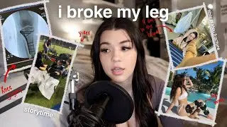 I BROKE MY LEG & this is what happened...