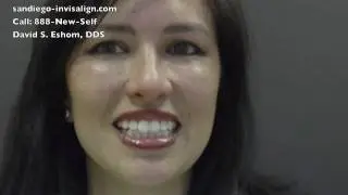Invisalign for Dominque in San Diego