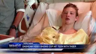 Teen Brain Damaged After Cop Uses Taser - Police Brutality?
