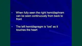 Which side is the diaphragm? How to tell on the lateral chest x-ray