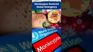 Monkeypox Declared Global Emergency | WHO | Current Affairs Today #currentaffairs #upsc