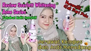 Review Scarlett Whitening Acne Series - Cocok Untuk Kulit Sensitif