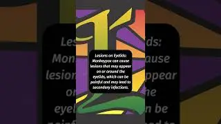 Monkey Pox and the EYE - IMPORTANT THINGS TO KNOW