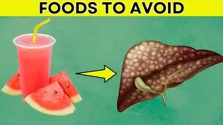 IMMEDIATELY Avoid These 8 Types Of Foods If You Have A Fatty Liver | Daily Joy