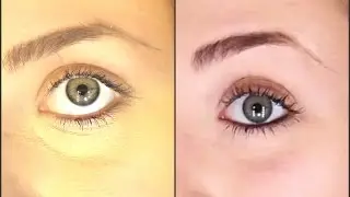 מניעת קמטים מתחת לעיניים | how to prevent creasing under the eyes