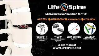 Micro Invasive Expandable Spacer, TRULIFT®