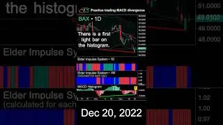 Learn to trade bullish MACD divergence on BAX stock 