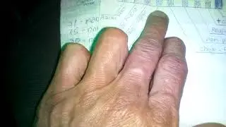 Установка торпеды с Опель Астра в Славуту