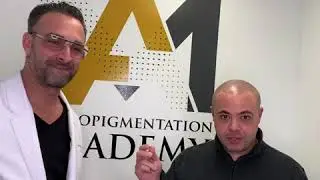 Effective Scalp Micropigmentation Treatment results