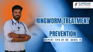 Ringworm Explained: Causes, Prevention & Treatments