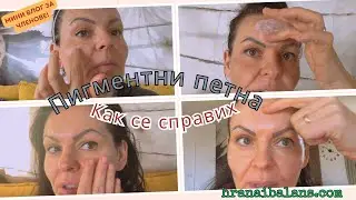 Как се справих с пигментните петна - Мини Влог