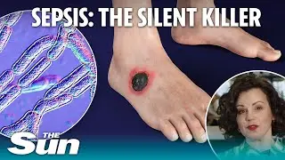 Dr Philippa Kaye on the signs, symptoms and best ways to avoid sepsis