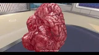 Discover the Brain and Skull in Virtual Reality | Real Footage from Osso VR