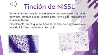 EXPOSICIÓN TINCIONES