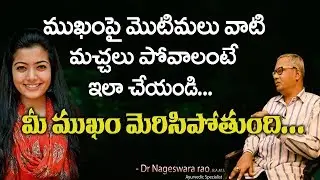 ముఖంపై మొటిమలు వాటి మచ్చలు పోవాలంటే  || Mukhapai motimalu,machalu povalante