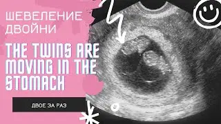 Шевеление двойни в животе/The twins are moving in the stomach