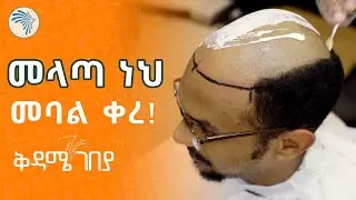 መላጣ መባል ድሮ ቀረ | ቅዳሜ ገበያ @ArtsTvWorld