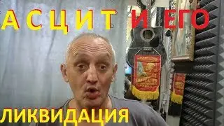 АСЦИТ - часть ВТОРАЯ