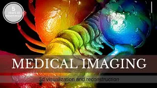 Post Processing Services For MRI And CT Studies