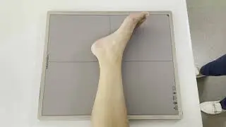 Укладка голеностопного сустава