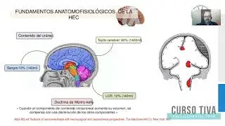 TIVA en Neurocirugía ¿Es mejor opción?