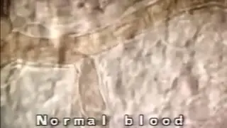 Blood flow after fatty meal 1