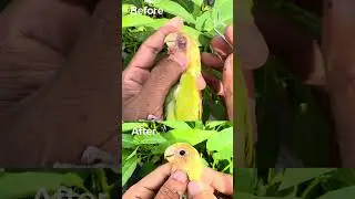 Before after Overcomesnot 