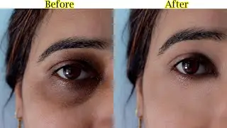 How To Remove DARK CIRCLES in Photoshop