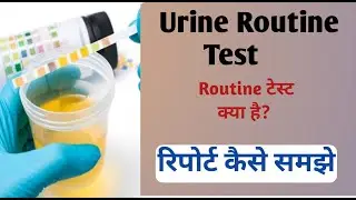 urine routine test I urine routine test report