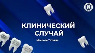 Восстановление зуба по ключу