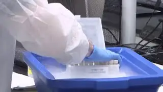Could Alzheimer’s blood tests replace spinal fluid tests? Study shows how well blood tests perform