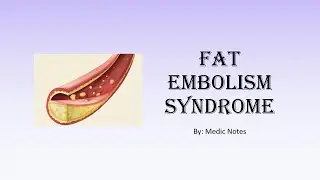 Fat embolism syndrome - pathophysiology, Gurd criteria, signs & symptoms, treatment, prognosis