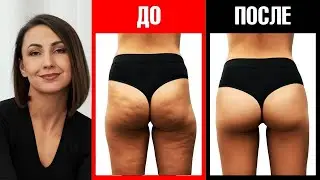 Лимфодренажная практика.  Снимаем отёчность
