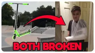 How I Broke Both of my Arms at Once - Source28 Origin Story
