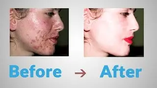 how to remove spot - Healing Brush tool and Spot Healing Brush tool in Photoshop Tutorial
