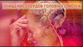От склероза сосудов головного мозга