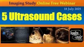 5 Ultrasound Cases || Imaging Study || 18 July 2025 || Online Webinar