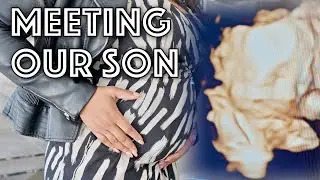 Meeting Our Son *4D Scan*