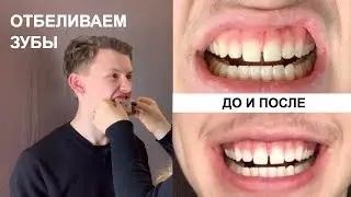 ОТБЕЛИВАНИЕ ЗУБОВ В ДОМАШНИХ УСЛОВИЯХ 🇺🇸ЭЛЯ В США S2E41