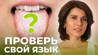 Налет на языке. Белый, Желтый, Коричневый: что значат разные цвета?
