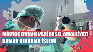 Doppler Kullanarak Mikrocerrahi Varikosel amaleiyatı & Damar Çıkarma İşlemi
