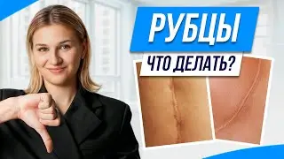 Как избавиться от ШРАМОВ и РУБЦОВ? / Обзор методов от косметолога