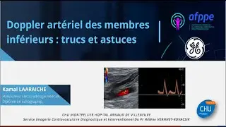 Échographie des Doppler artériel des membres inférieurs : trucs et astuces (Manip to Manip)